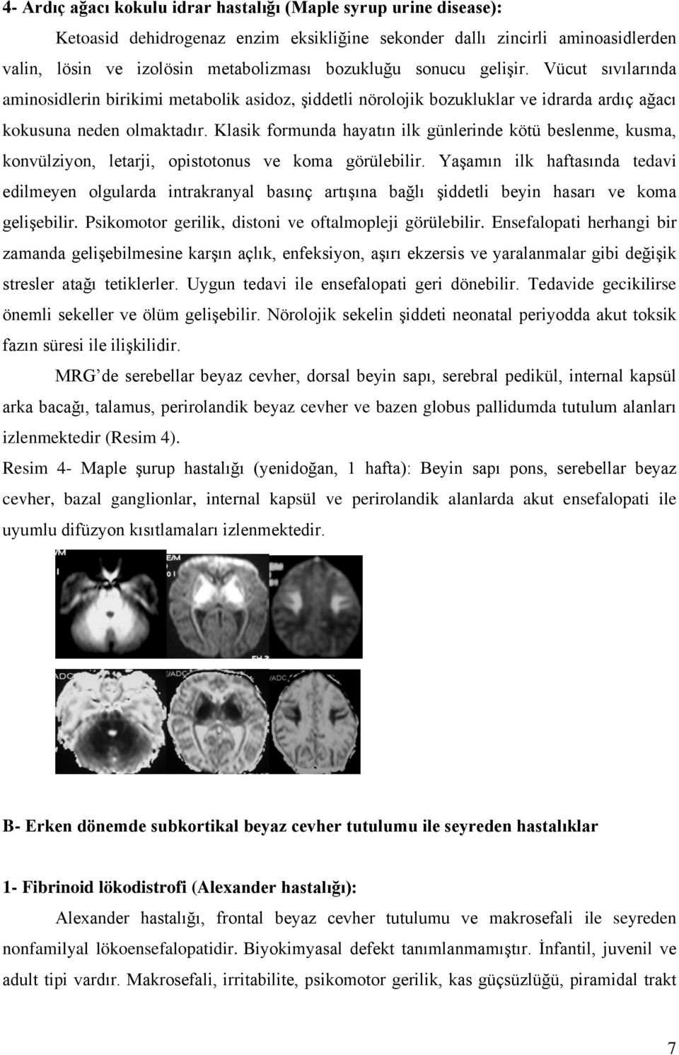 Klasik formunda hayatın ilk günlerinde kötü beslenme, kusma, konvülziyon, letarji, opistotonus ve koma görülebilir.