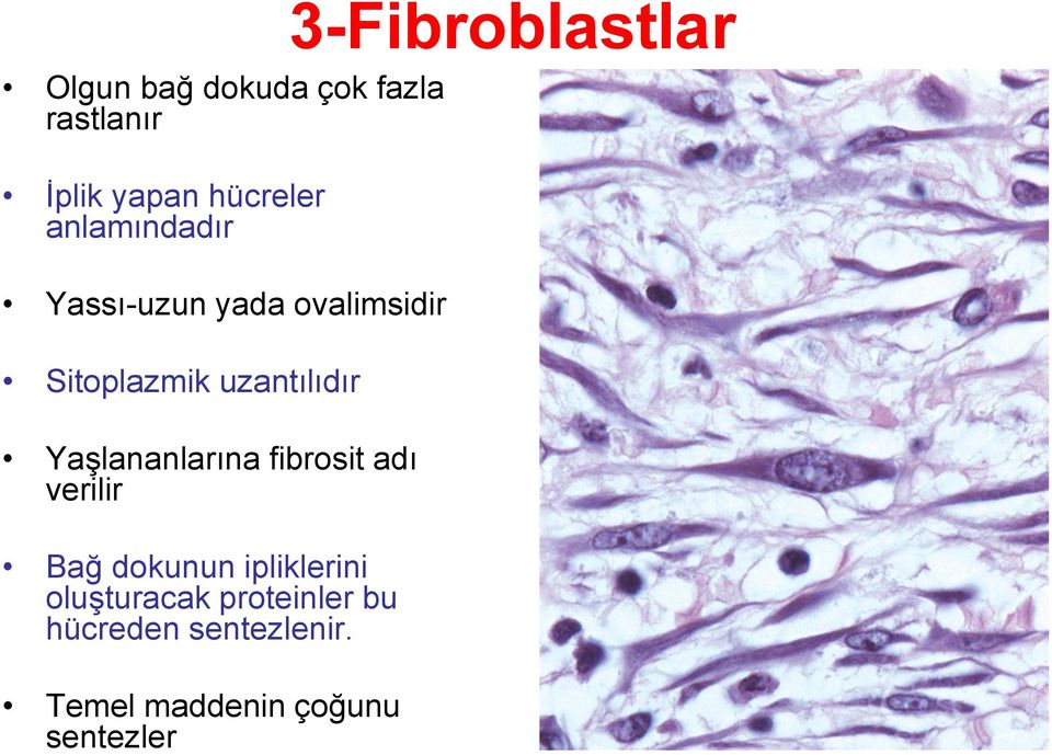 Yaşlananlarına fibrosit adı verilir Bağ dokunun ipliklerini