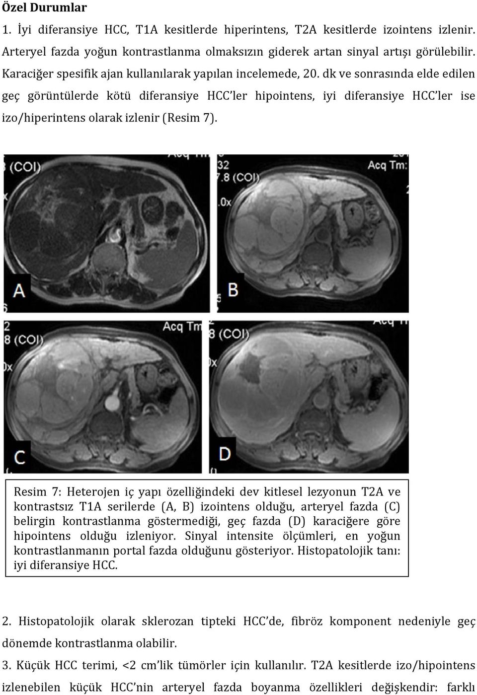dk ve sonrasında elde edilen geç görüntülerde kötü diferansiye HCC ler hipointens, iyi diferansiye HCC ler ise izo/hiperintens olarak izlenir (Resim 7).