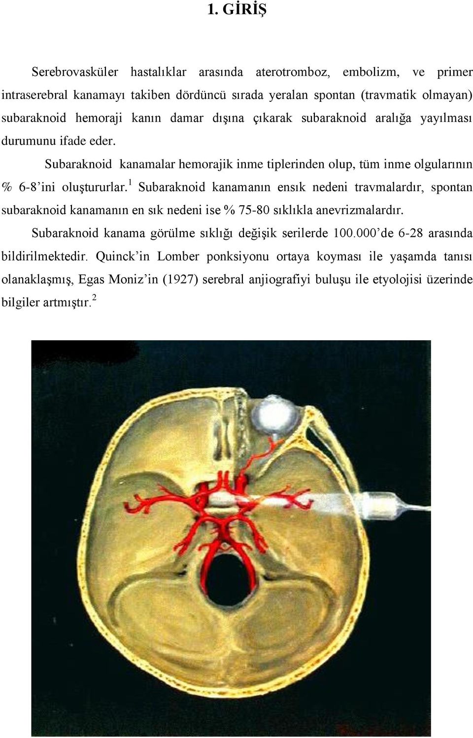 1 Subaraknoid kanamanın ensık nedeni travmalardır, spontan subaraknoid kanamanın en sık nedeni ise % 75-80 sıklıkla anevrizmalardır. Subaraknoid kanama görülme sıklığı değişik serilerde 100.