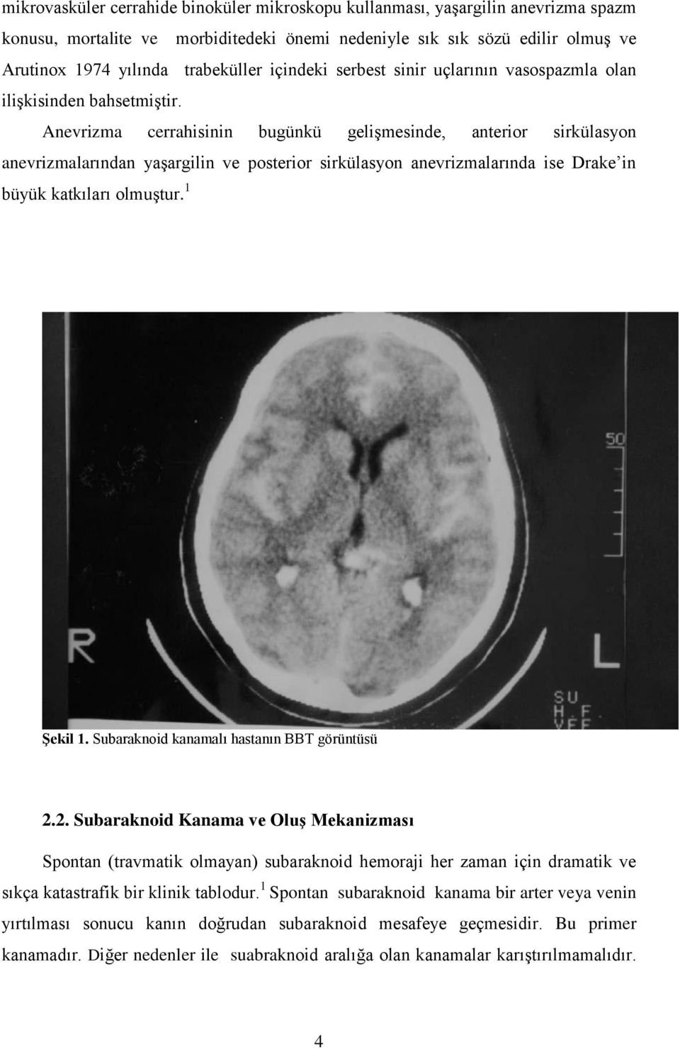 Anevrizma cerrahisinin bugünkü gelişmesinde, anterior sirkülasyon anevrizmalarından yaşargilin ve posterior sirkülasyon anevrizmalarında ise Drake in büyük katkıları olmuştur. 1 Şekil 1.