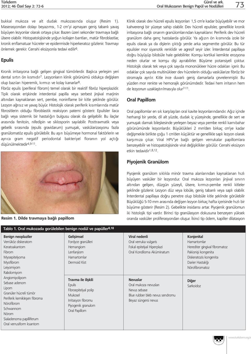 Histopatolojisinde yoğun kollajen bantları, matür fibroblastlar, kronik enflamatuar hücreler ve epidermisde hiperkeratoz gözlenir. Travmayı önlemek gerekir. Cerrahi eksizyonla tedavi edilir 6.