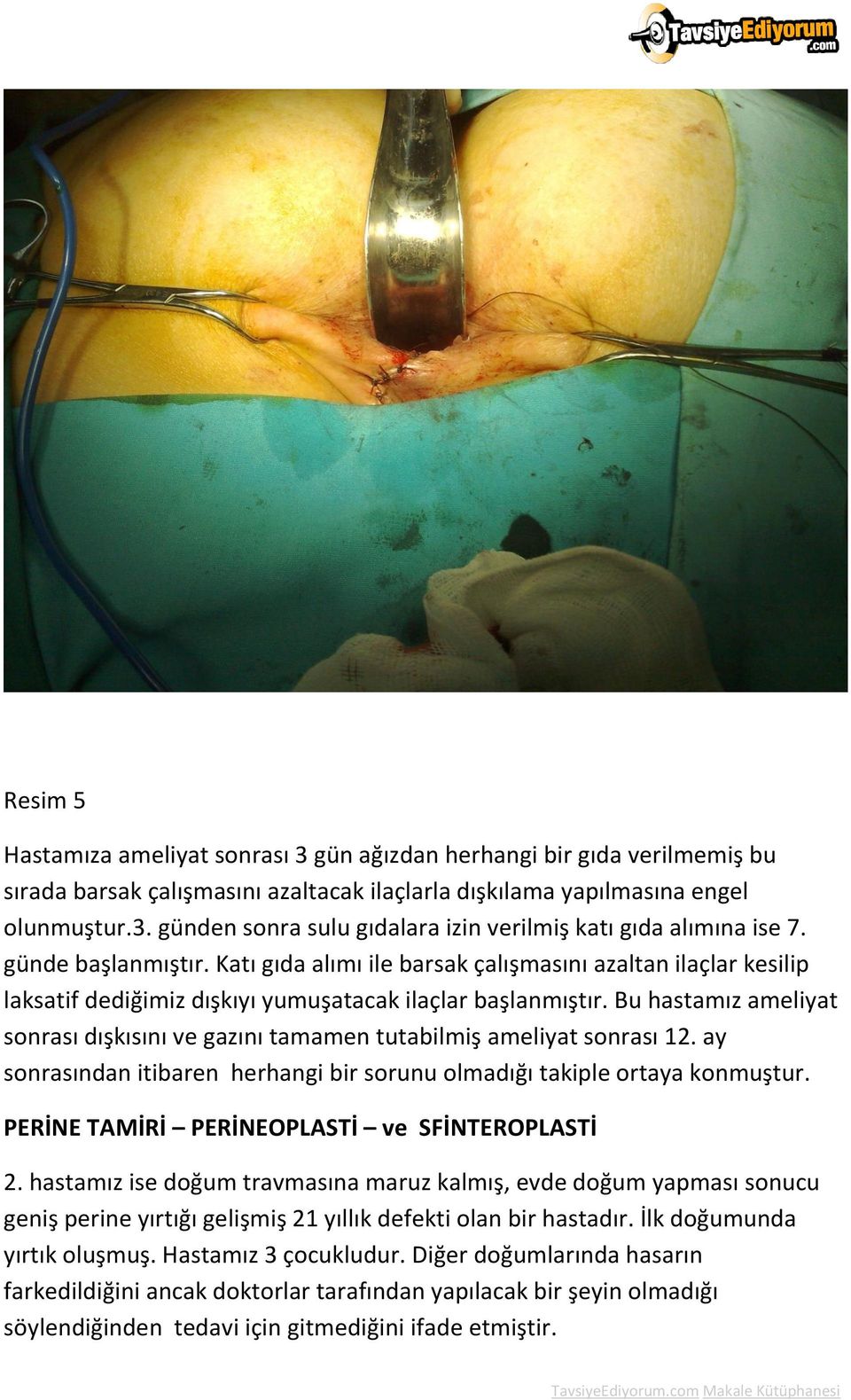 Bu hastamız ameliyat sonrası dışkısını ve gazını tamamen tutabilmiş ameliyat sonrası 12. ay sonrasından itibaren herhangi bir sorunu olmadığı takiple ortaya konmuştur.