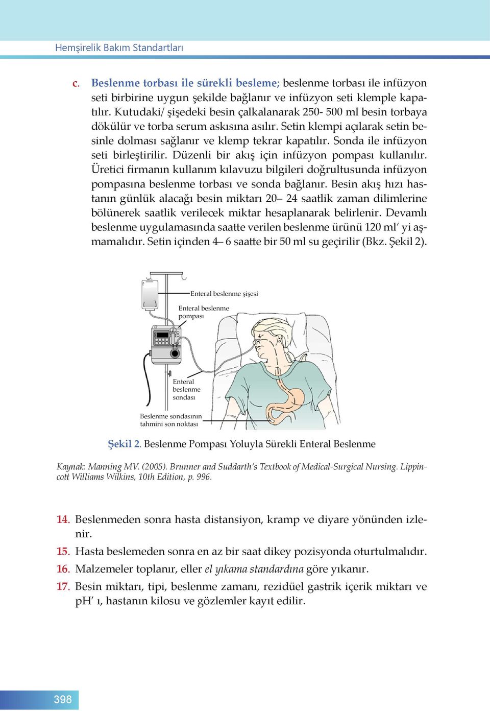 Sonda ile infüzyon seti birleştirilir. Düzenli bir akış için infüzyon pompası kullanılır.