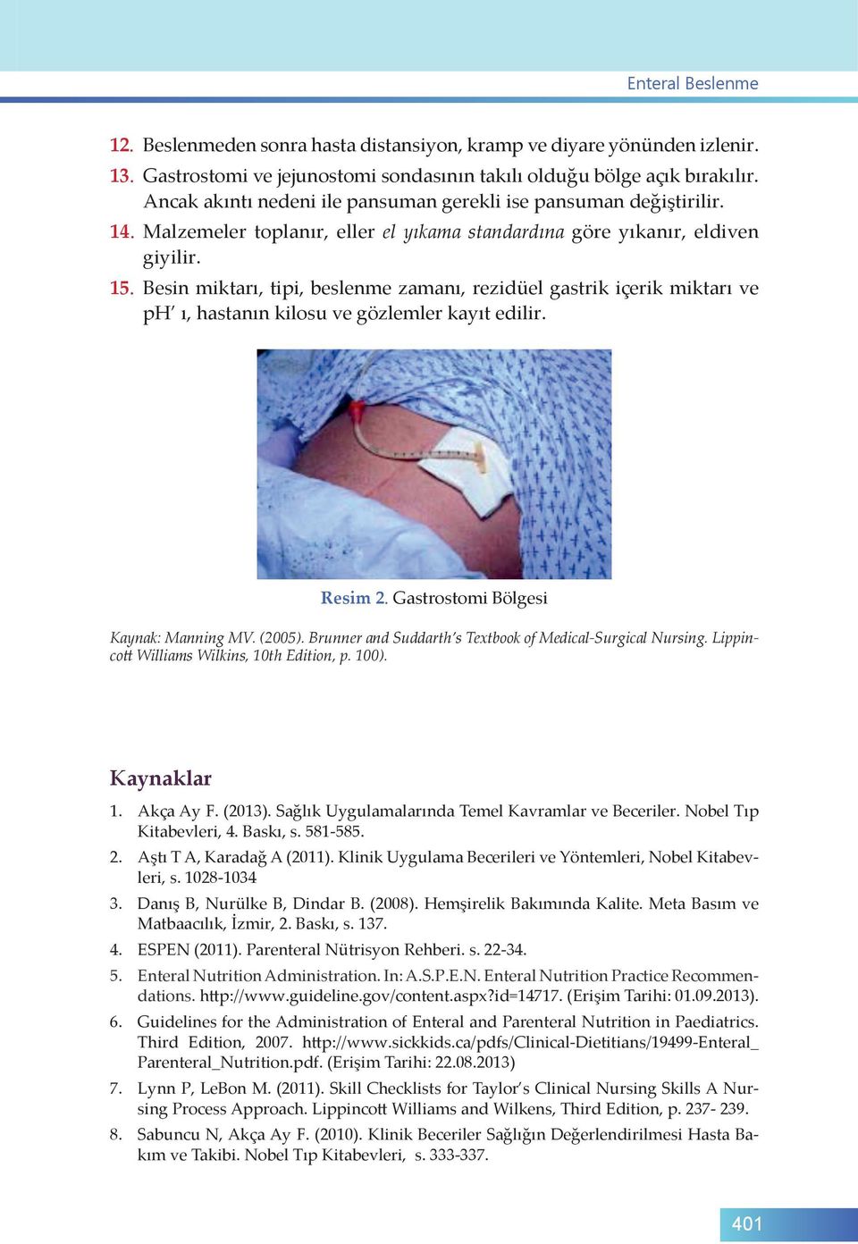 Besin miktarı, tipi, beslenme zamanı, rezidüel gastrik içerik miktarı ve ph ı, hastanın kilosu ve gözlemler kayıt edilir. Resim 2. Gastrostomi Bölgesi Kaynak: Manning MV. (2005).