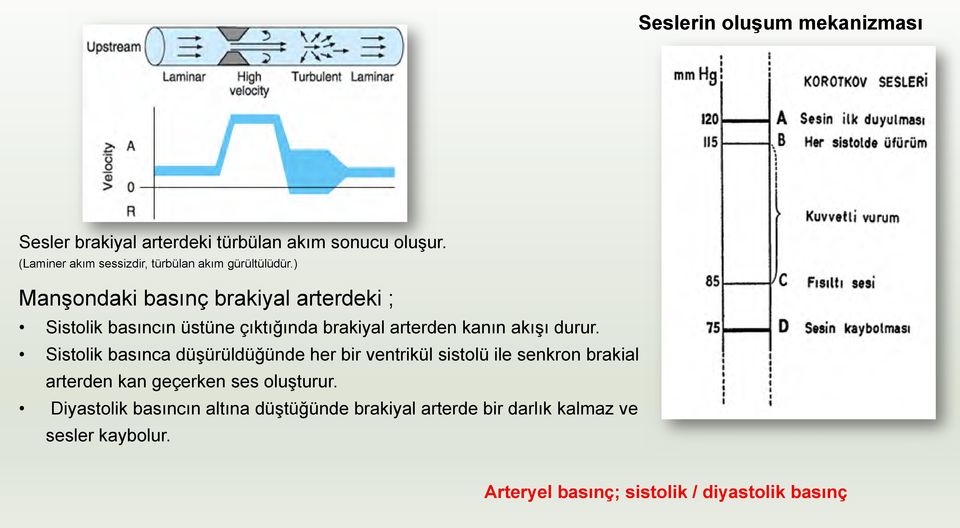 ) Manşondaki basınç brakiyal arterdeki ; Sistolik basıncın üstüne çıktığında brakiyal arterden kanın akışı durur.