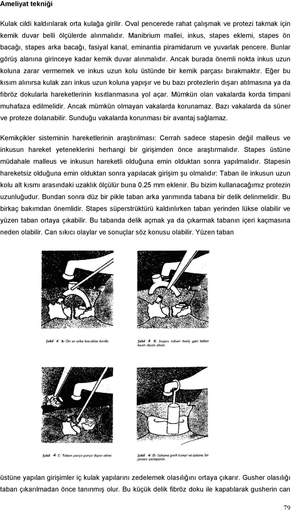 Ancak burada önemli nokta inkus uzun koluna zarar vermemek ve inkus uzun kolu üstünde bir kemik parçası bırakmaktır.