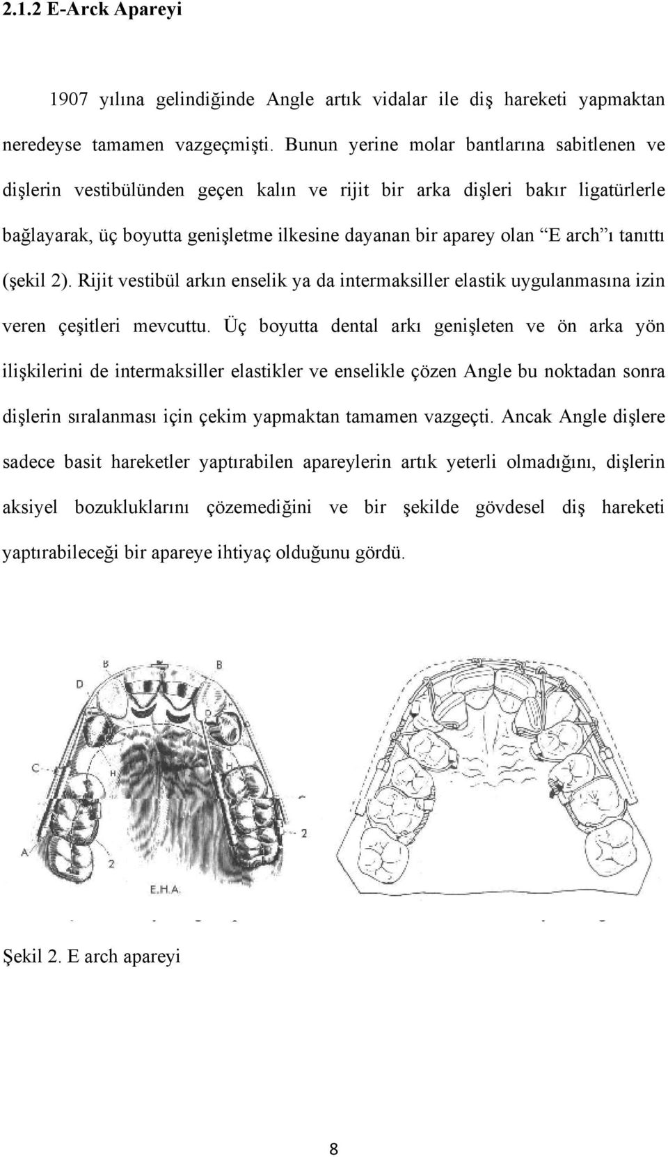 tanıttı (şekil 2). Rijit vestibül arkın enselik ya da intermaksiller elastik uygulanmasına izin veren çeşitleri mevcuttu.