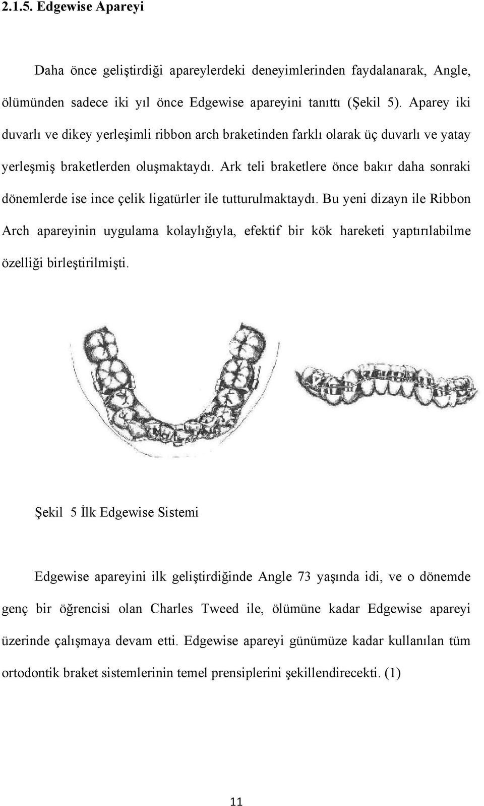 Ark teli braketlere önce bakır daha sonraki dönemlerde ise ince çelik ligatürler ile tutturulmaktaydı.