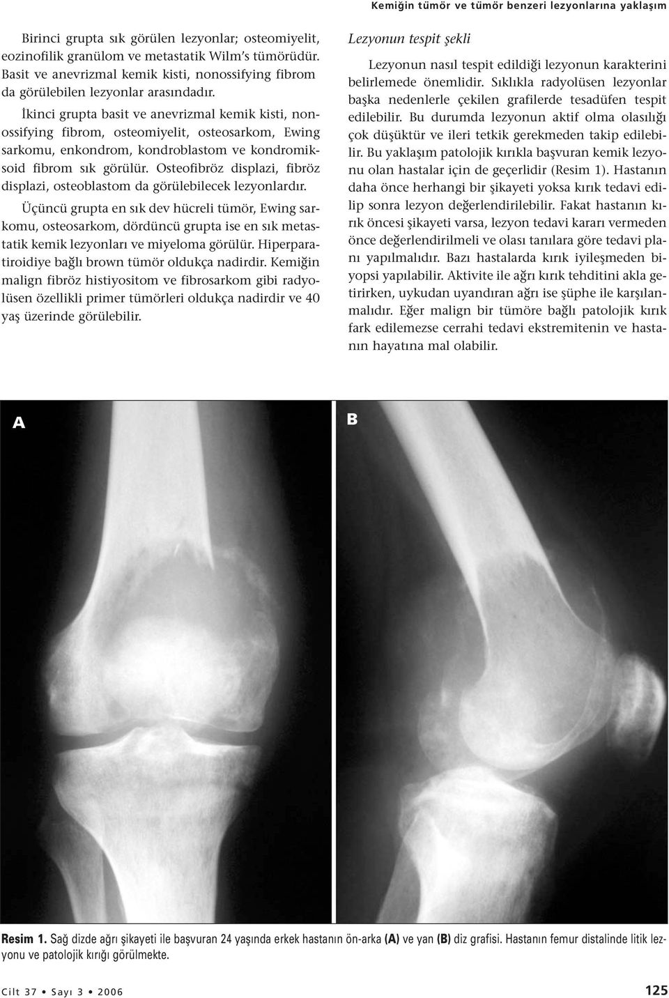 İkinci grupta basit ve anevrizmal kemik kisti, nonossifying fibrom, osteomiyelit, osteosarkom, Ewing sarkomu, enkondrom, kondroblastom ve kondromiksoid fibrom sık görülür.