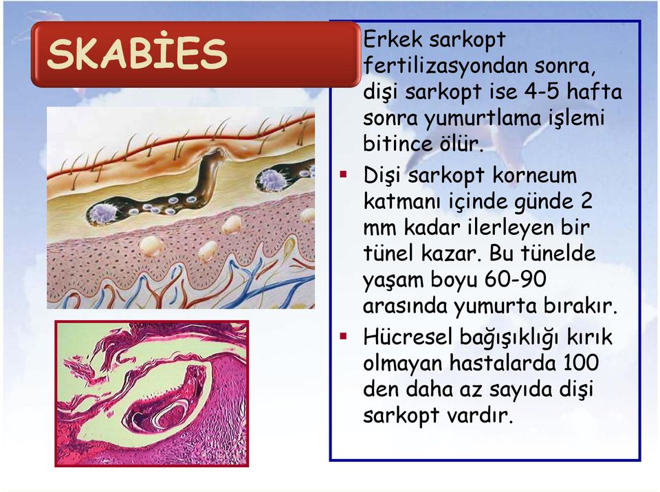 Dişi sarkopt korneum katmanı içinde günde 2 mm kadar ilerleyen bir tünel kazar.
