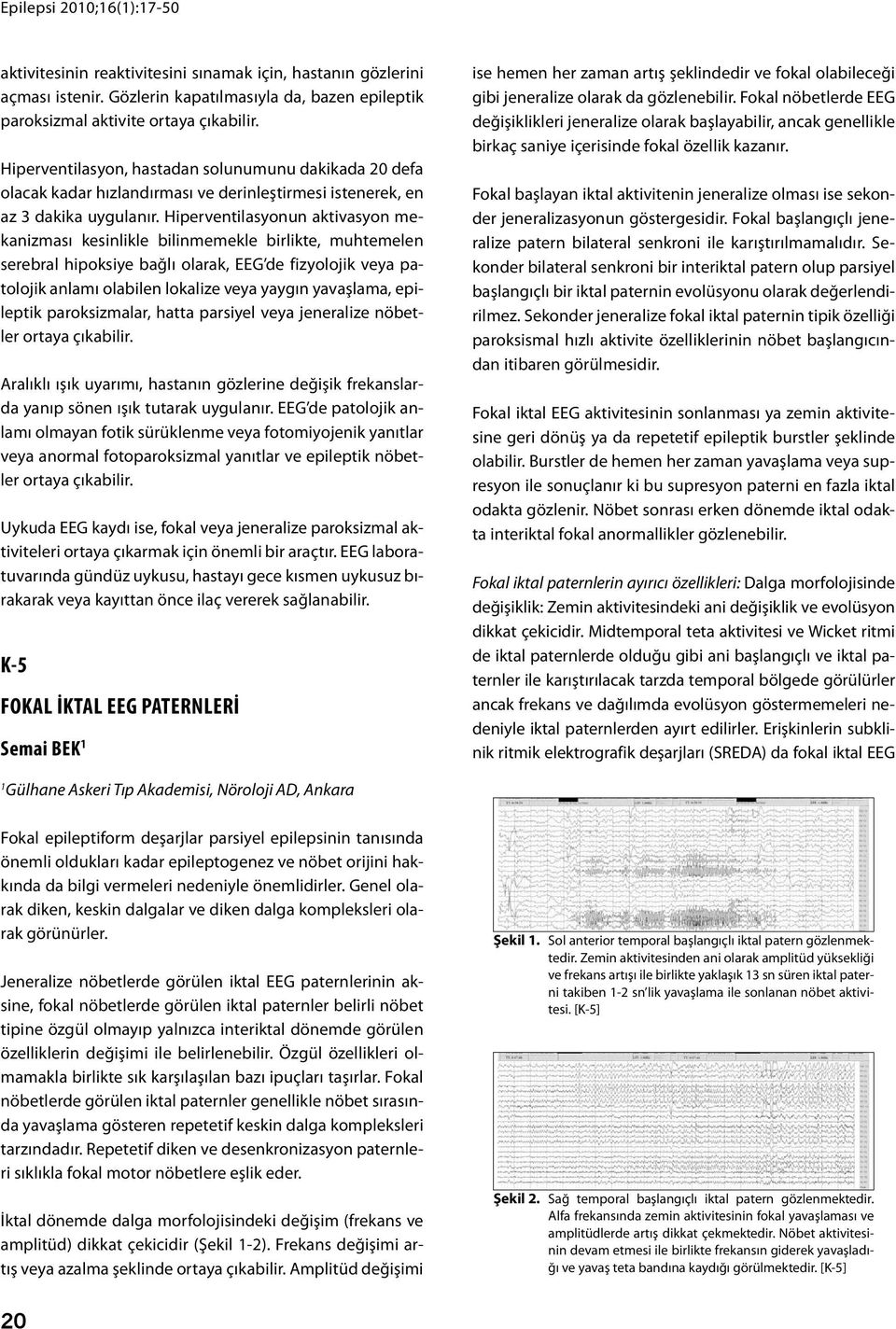 Hiperventilasyonun aktivasyon mekanizması kesinlikle bilinmemekle birlikte, muhtemelen serebral hipoksiye bağlı olarak, EEG de fizyolojik veya patolojik anlamı olabilen lokalize veya yaygın