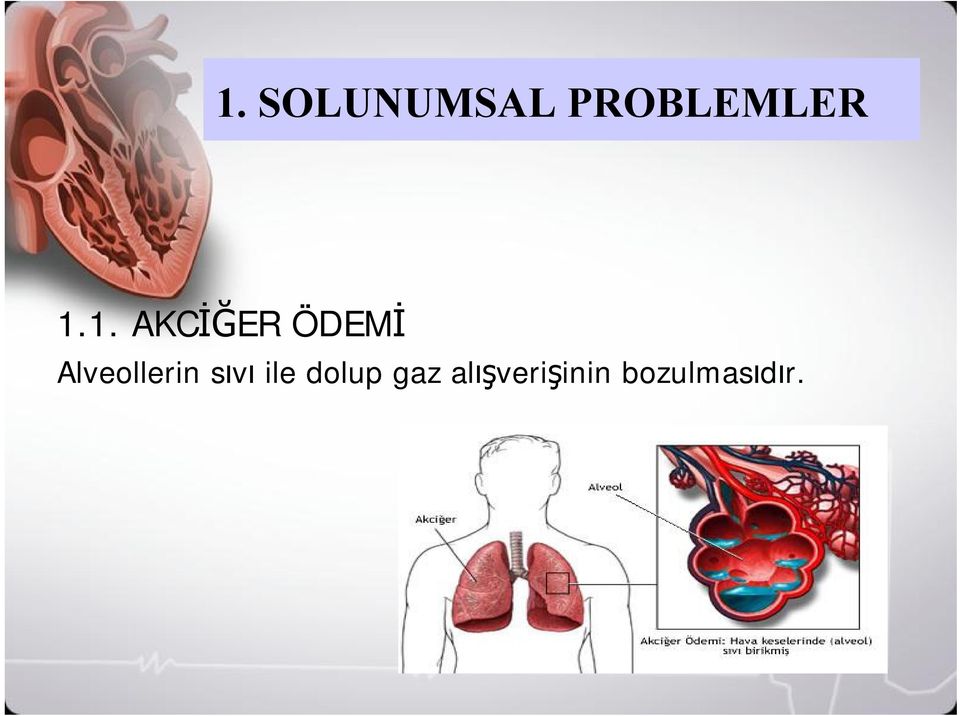 Alveollerin sıvıile dolup