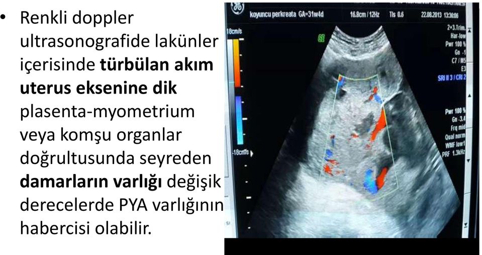 veya komşu organlar doğrultusunda seyreden damarların