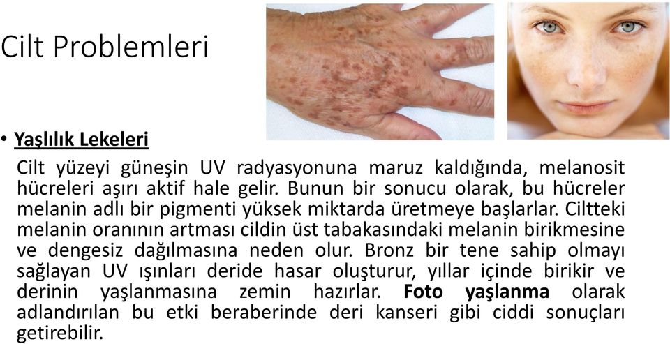 Ciltteki melanin oranının artması cildin üst tabakasındaki melanin birikmesine ve dengesiz dağılmasına neden olur.