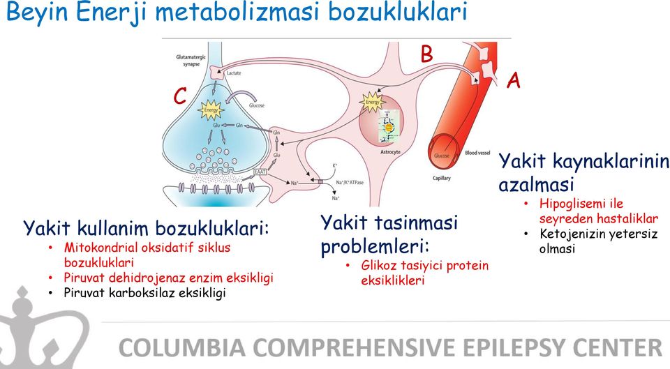 Piruvat karboksilaz eksikligi Yakit tasinmasi problemleri: Glikoz tasiyici protein