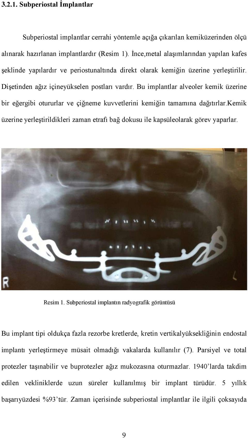 Bu implantlar alveoler kemik üzerine bir eğergibi otururlar ve çiğneme kuvvetlerini kemiğin tamamına dağıtırlar.