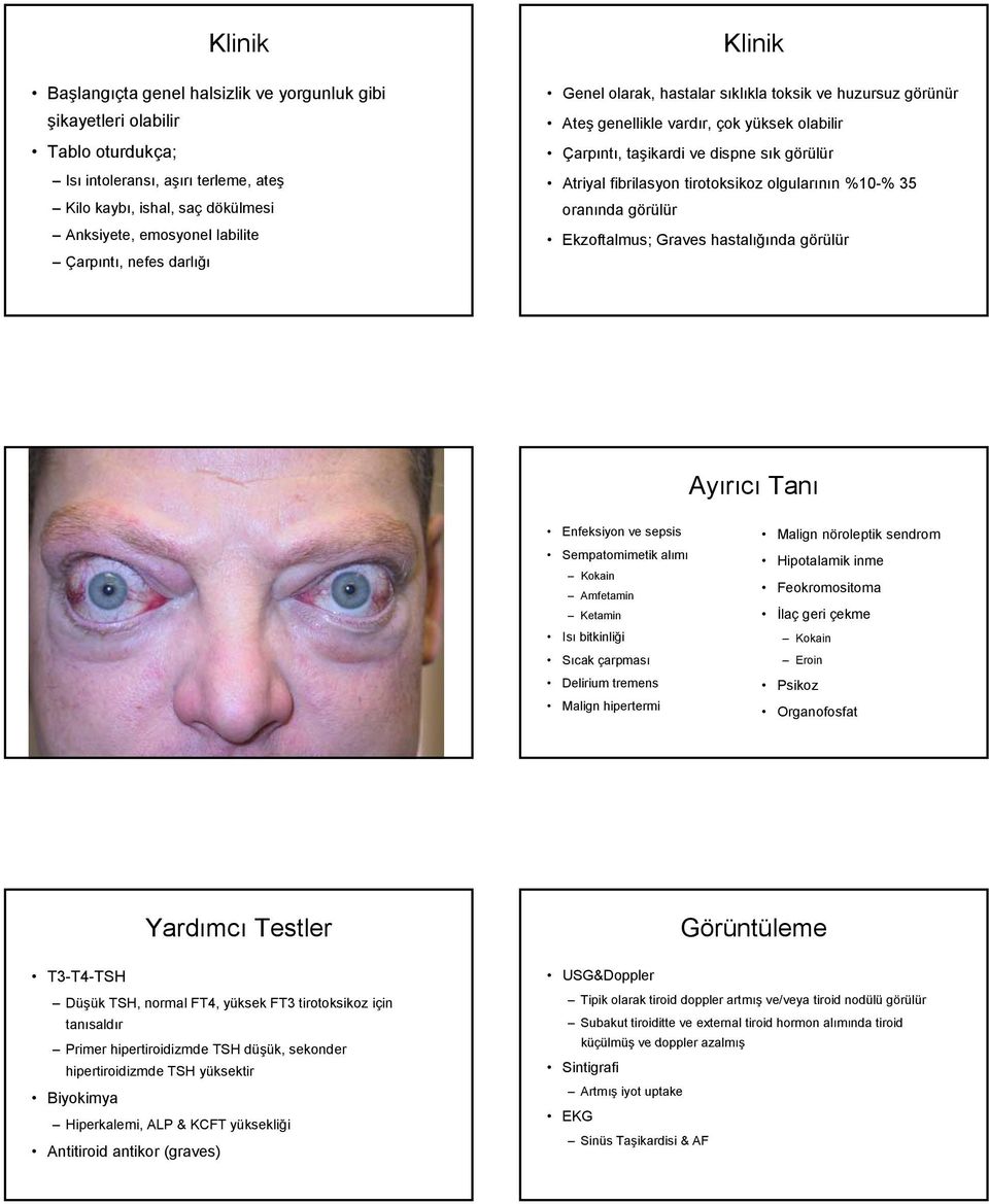 %10-% 35 oranında görülür Ekzoftalmus; Graves hastalığında görülür Ayırıcı Tanı Enfeksiyon ve sepsis Sempatomimetik alımı Kokain Amfetamin Ketamin Isı bitkinliği Sıcak çarpması Delirium tremens