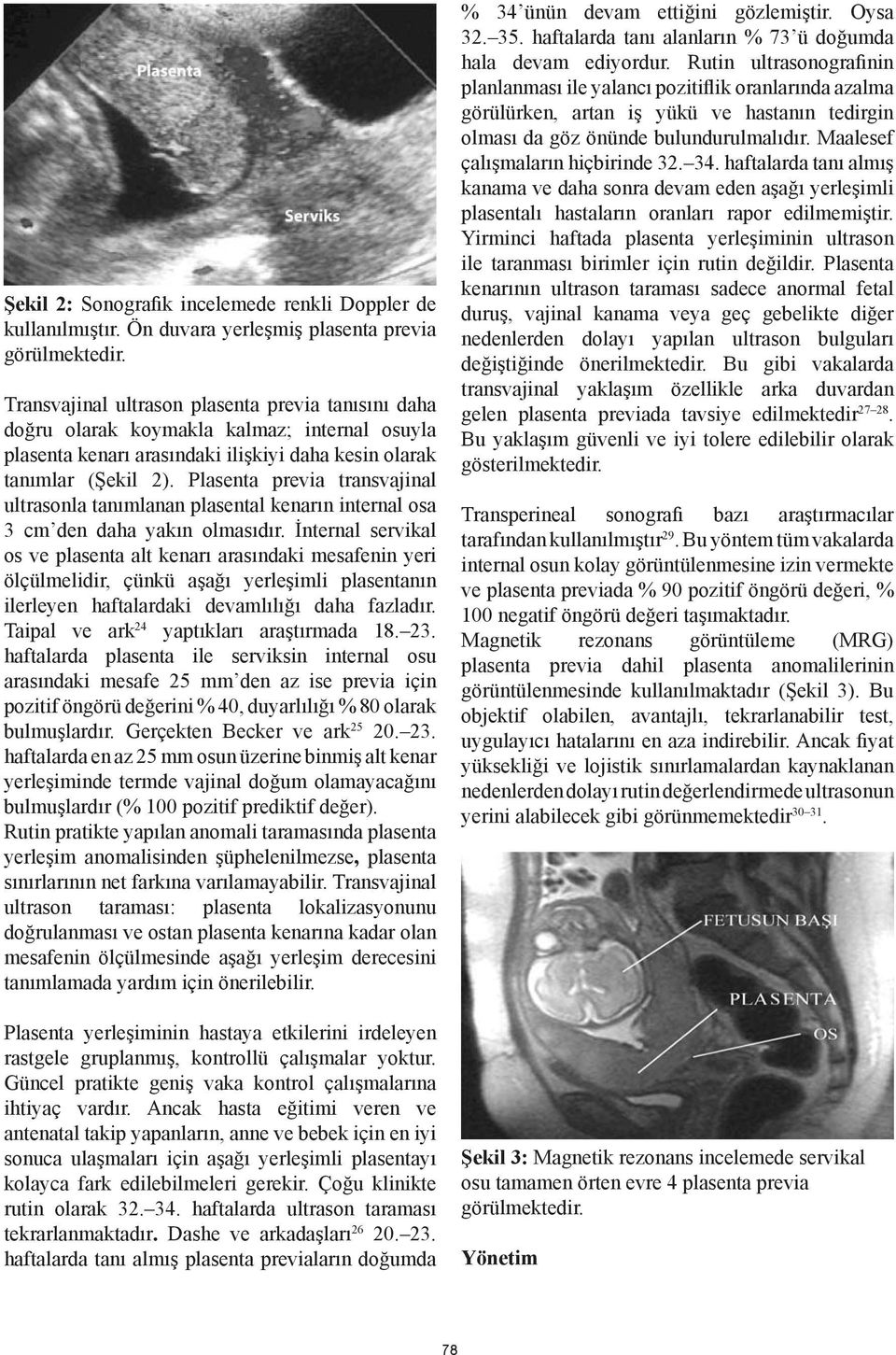 Plasenta previa transvajinal ultrasonla tanımlanan plasental kenarın internal osa 3 cm den daha yakın olmasıdır.