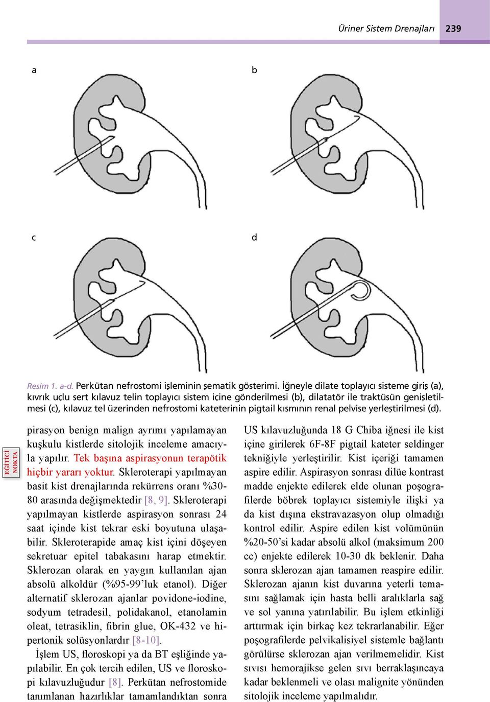 kateterinin pigtail kısmının renal pelvise yerleştirilmesi (d). pirasyon benign malign ayrımı yapılamayan kuşkulu kistlerde sitolojik inceleme amacıyla yapılır.