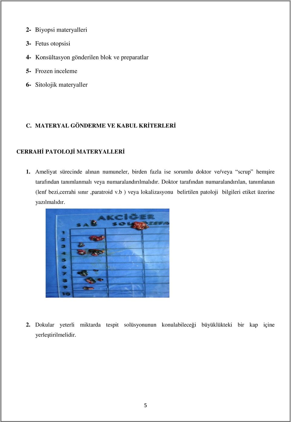 Ameliyat sürecinde alınan numuneler, birden fazla ise sorumlu doktor ve/veya scrup hemşire tarafından tanımlanmalı veya numaralandırılmalıdır.