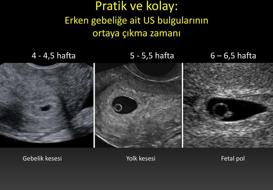 4-4,5 hafta 5-5,5 hafta 6 6,5 hafta