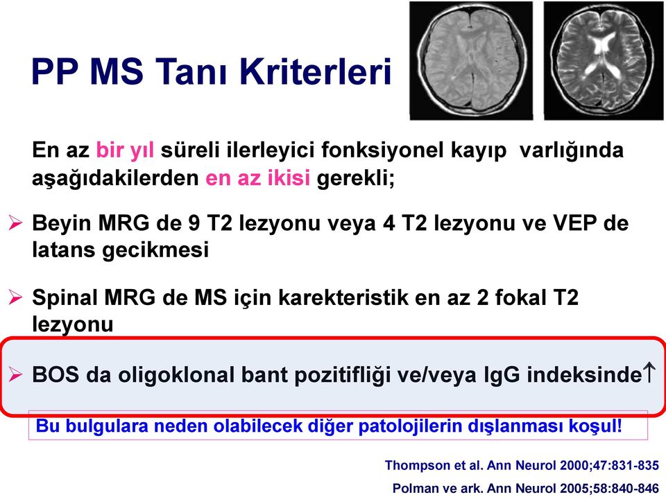 en az 2 fokal T2 lezyonu BOS da oligoklonal bant pozitifliği ve/veya IgG indeksinde Bu bulgulara neden olabilecek