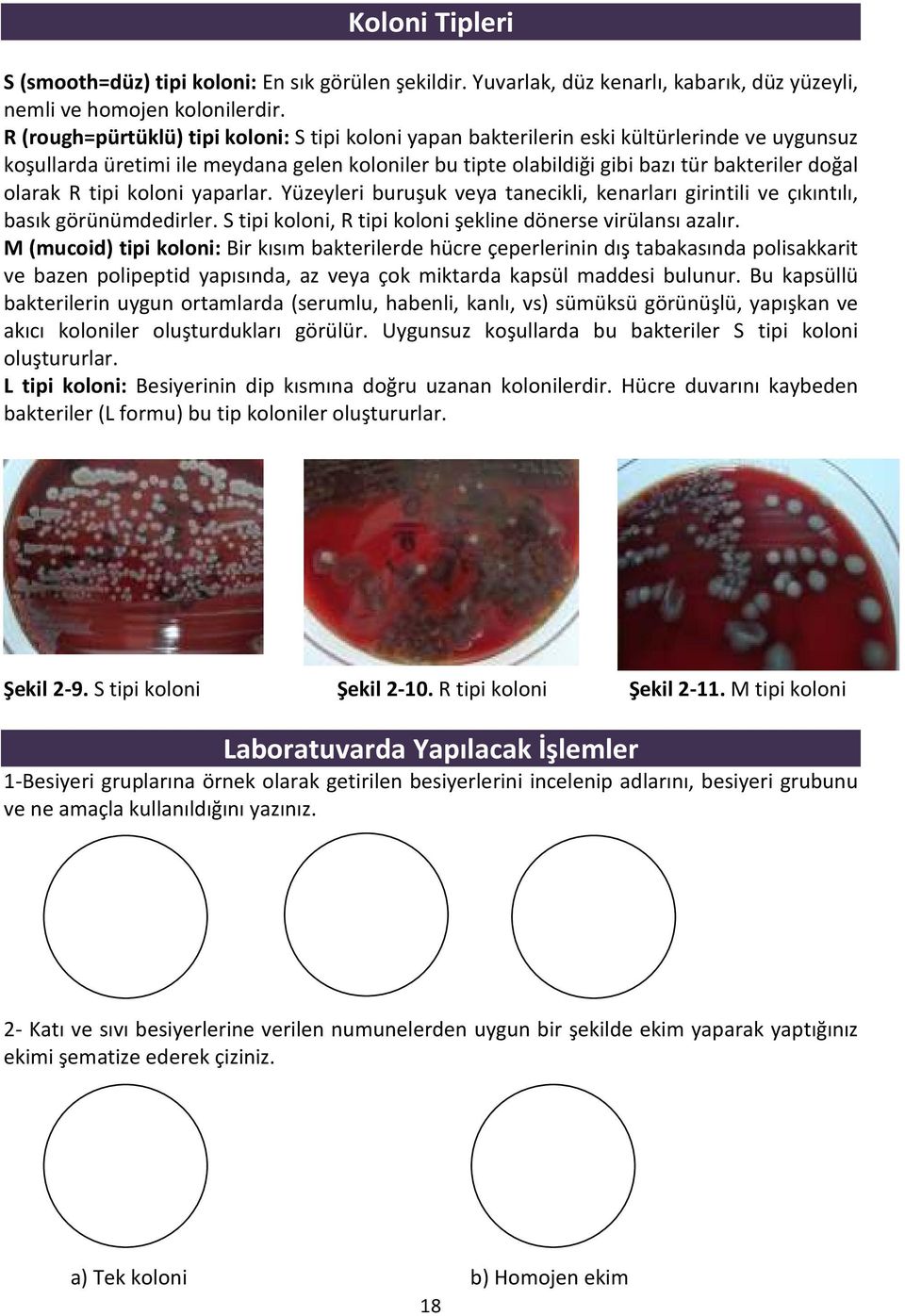 olarak R tipi koloni yaparlar. Yüzeyleri buruşuk veya tanecikli, kenarları girintili ve çıkıntılı, basık görünümdedirler. S tipi koloni, R tipi koloni şekline dönerse virülansı azalır.