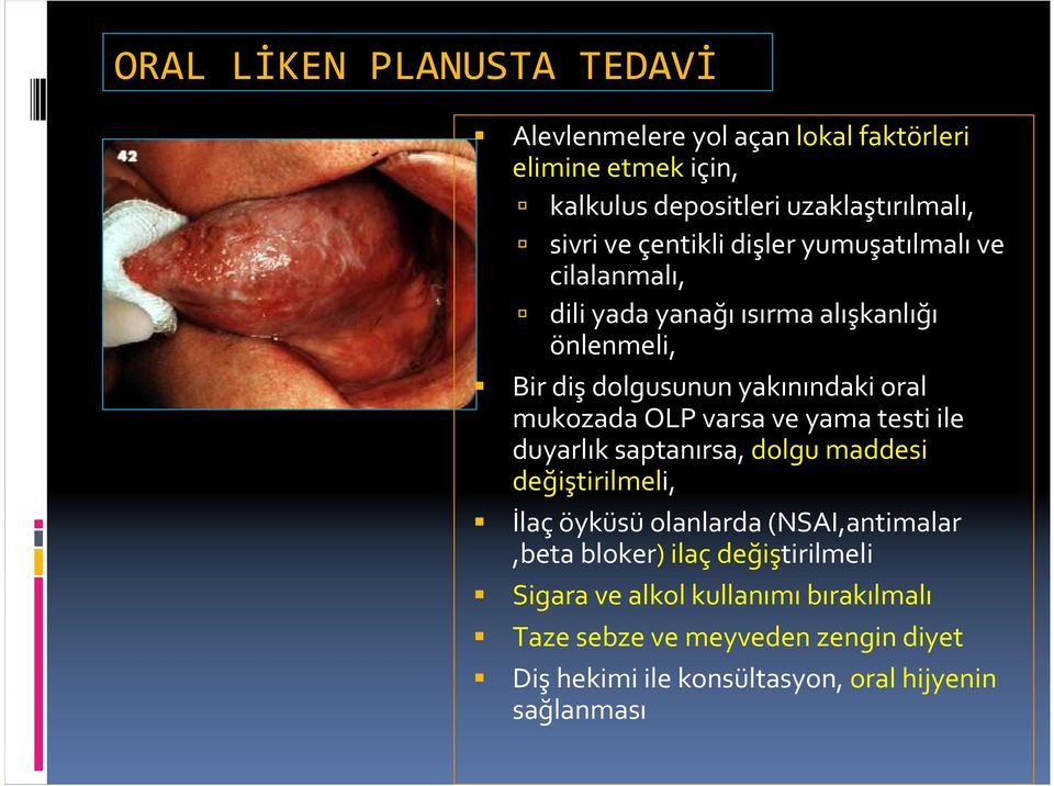 OLP varsa ve yama testi ile duyarlık saptanırsa, dolgu maddesi değiştirilmeli, İlaçöyküsüolanlarda (NSAI,antimalar,beta bloker) ilaç