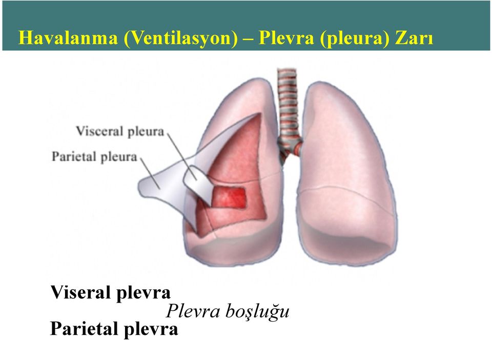 (pleura) Zarı Viseral