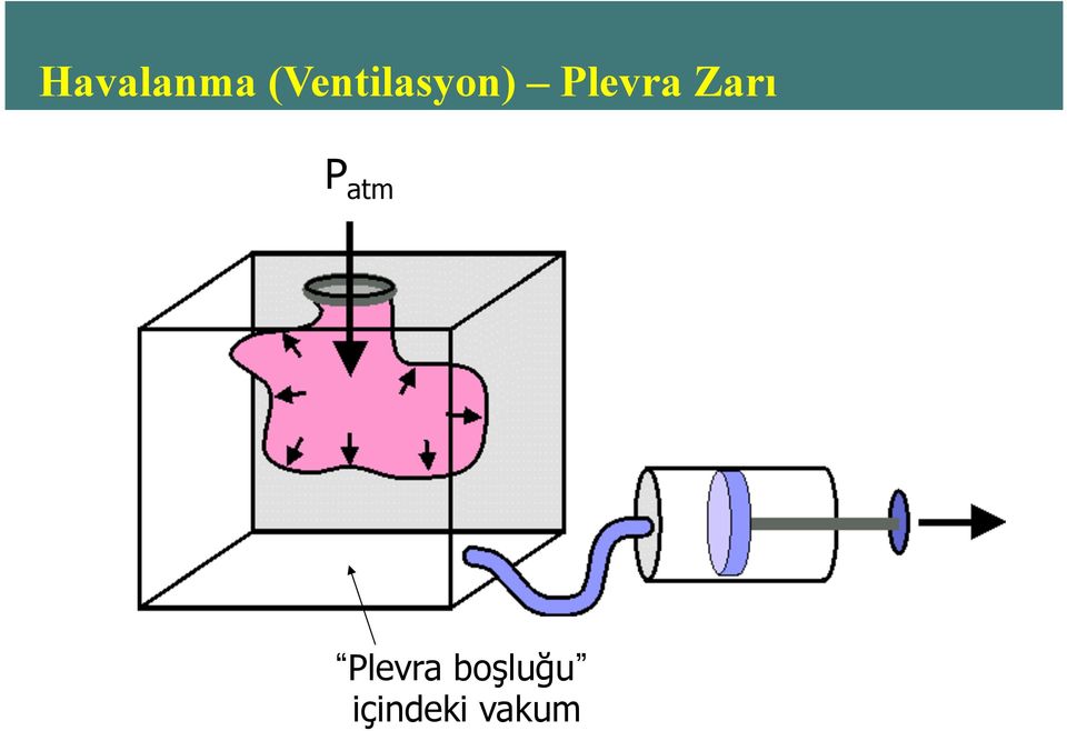 Plevra Zarı P atm