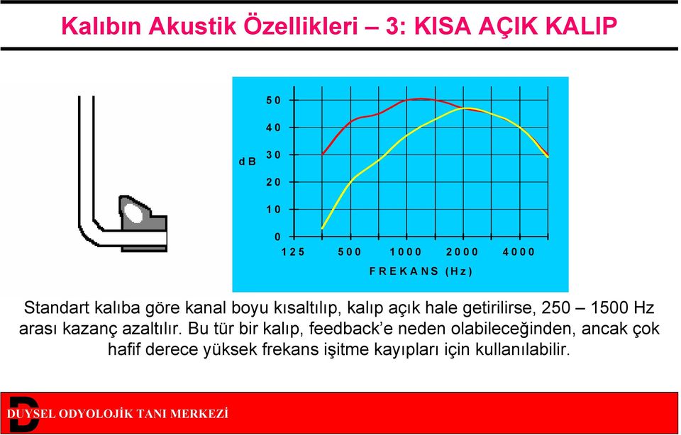 getirilirse, 250 1500 Hz arası kazanç azaltılır.