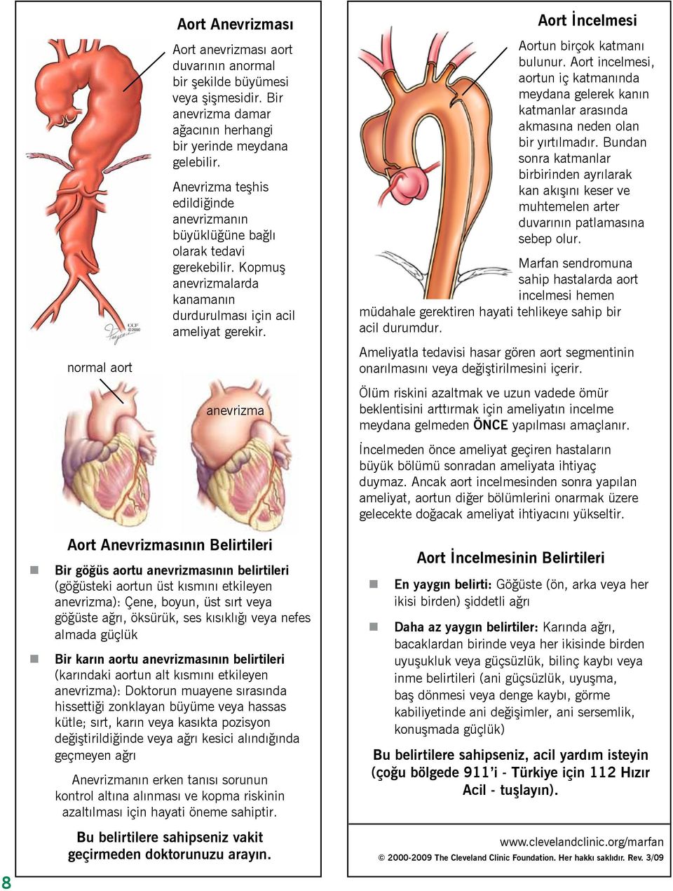 anevrizma Aort İncelmesi Aortun birçok katmanı bulunur. Aort incelmesi, aortun iç katmanında meydana gelerek kanın katmanlar arasında akmasına neden olan bir yırtılmadır.