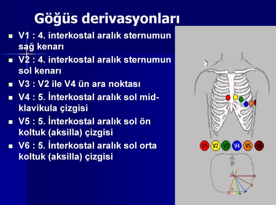 İnterkostal aralık sol midklavikula çizgisi V5 : 5.