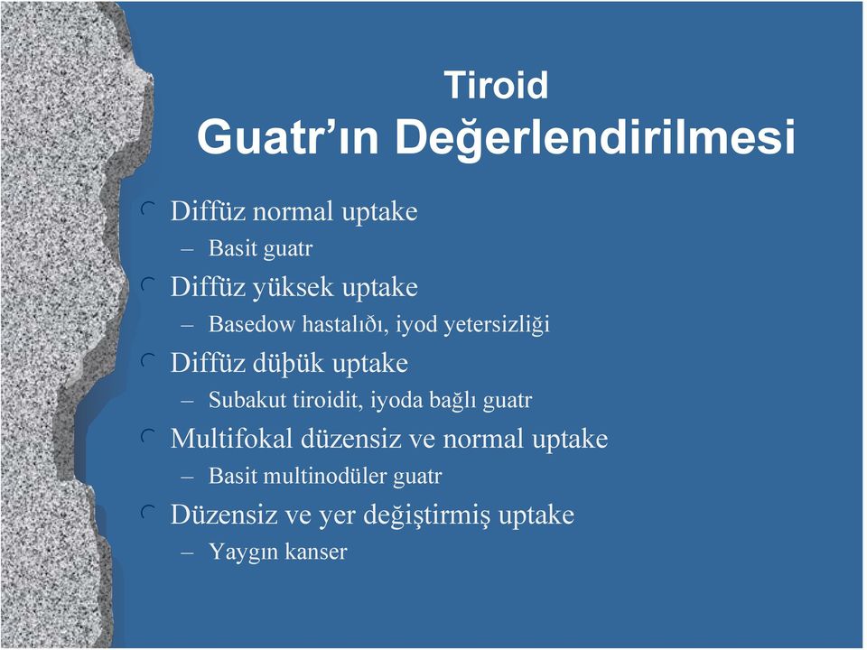 Subakut tiroidit, iyoda bağlı guatr l Multifokal düzensiz ve normal