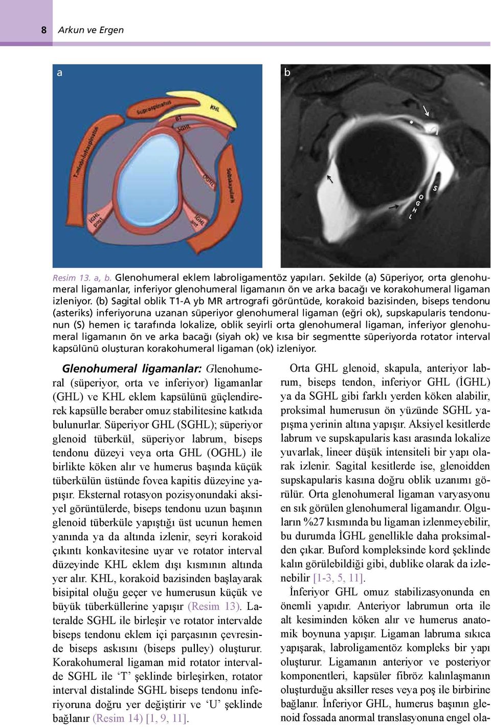 (b) Sagital oblik T1-A yb MR artrografi görüntüde, korakoid bazisinden, biseps tendonu (asteriks) inferiyoruna uzanan süperiyor glenohumeral ligaman (eğri ok), supskapularis tendonunun (S) hemen iç