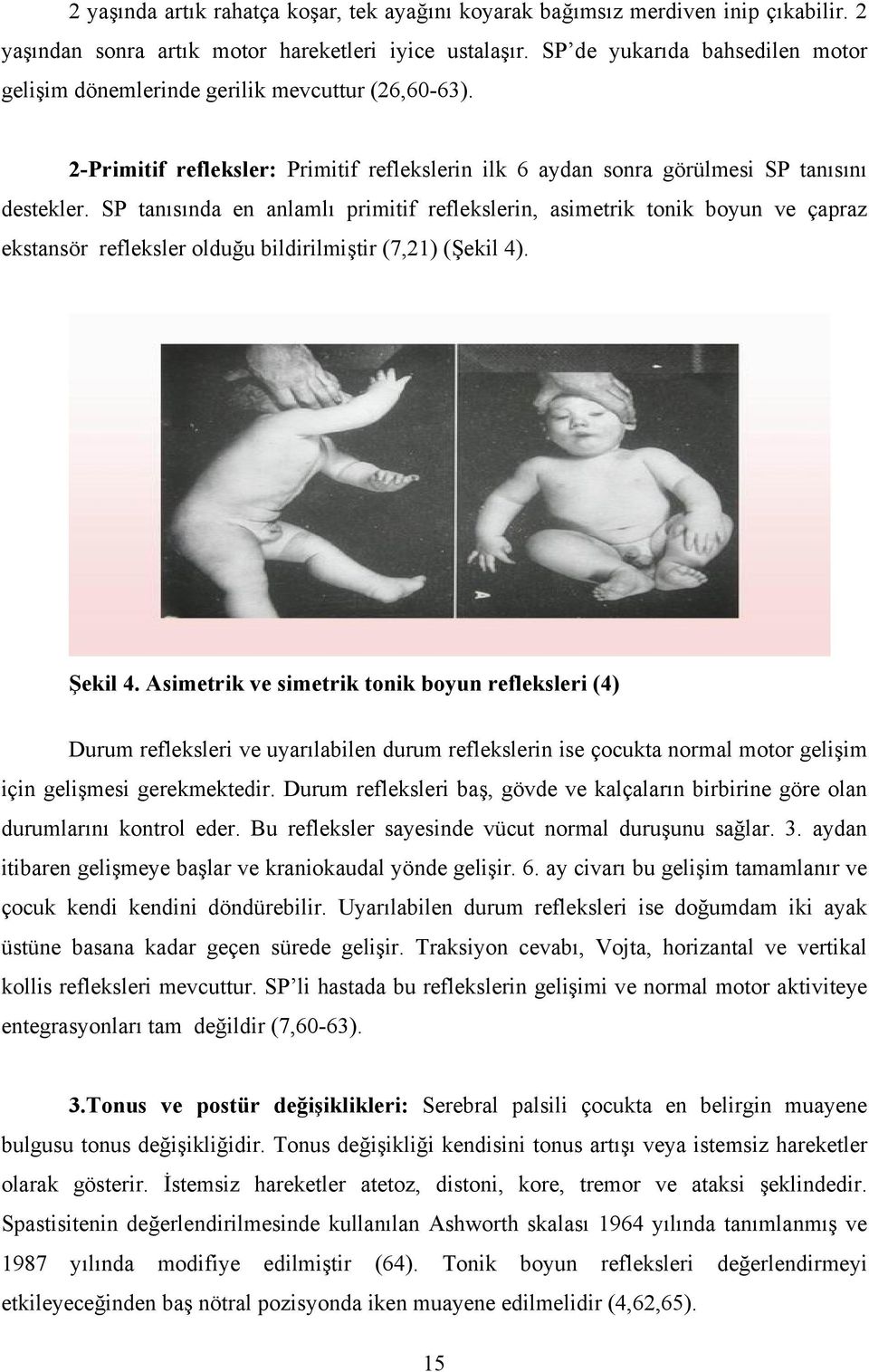 SP tanısında en anlamlı primitif reflekslerin, asimetrik tonik boyun ve çapraz ekstansör refleksler olduğu bildirilmiştir (7,21) (Şekil 4). Şekil 4.