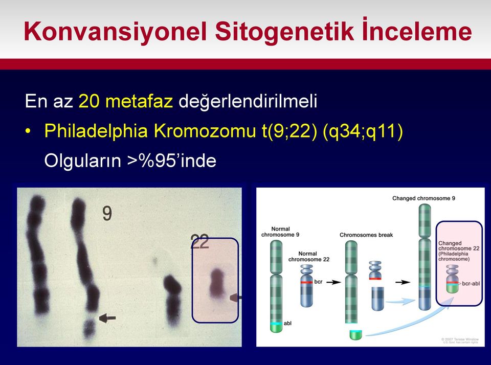 değerlendirilmeli Philadelphia