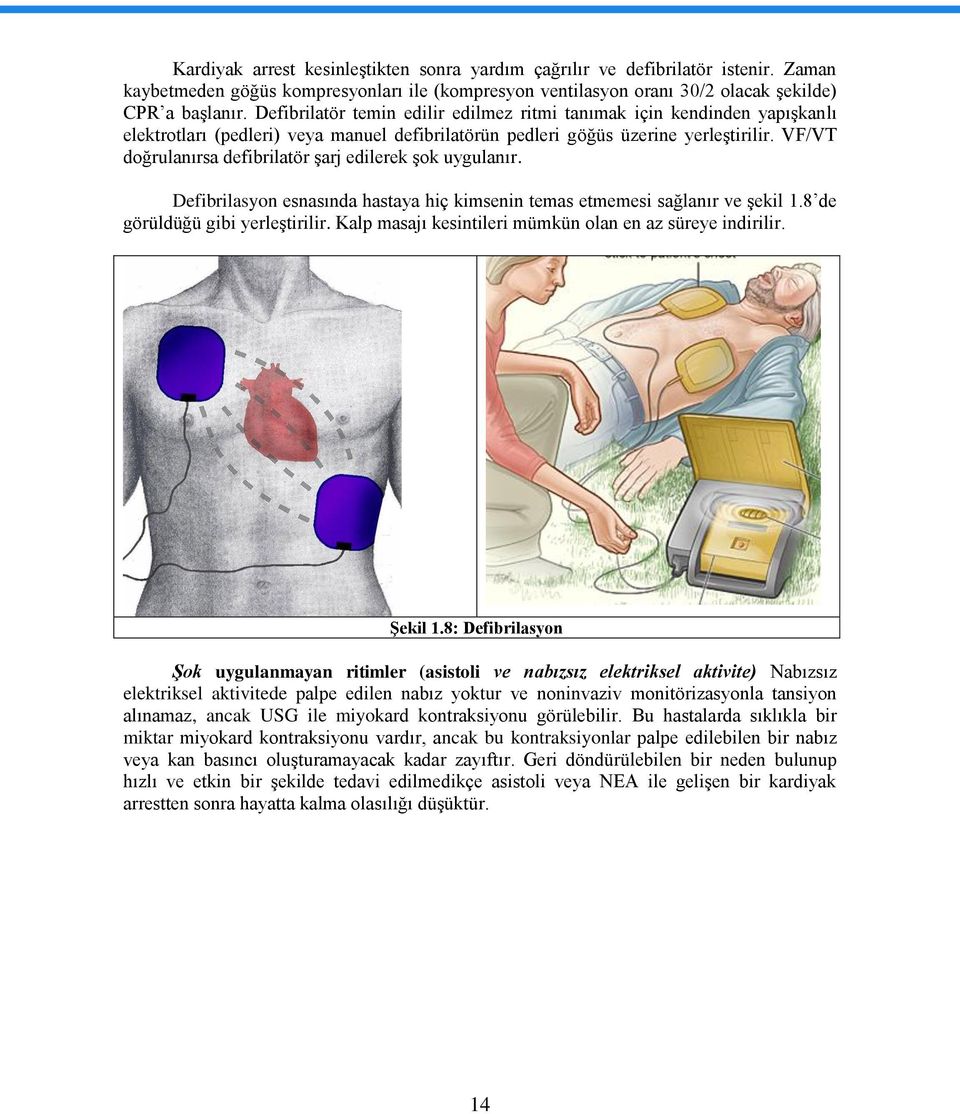 VF/VT doğrulanırsa defibrilatör şarj edilerek şok uygulanır. Defibrilasyon esnasında hastaya hiç kimsenin temas etmemesi sağlanır ve şekil 1.8 de görüldüğü gibi yerleştirilir.