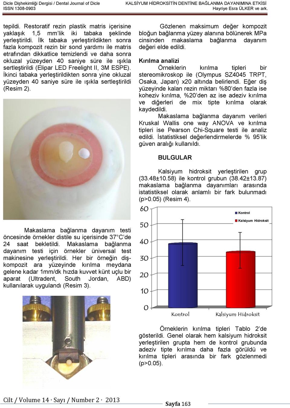 LED Freelight II, 3M ESPE). İkinci tabaka yerleştirildikten sonra yine okluzal yüzeyden 40 saniye süre ile ışıkla sertleştirildi (Resim 2).