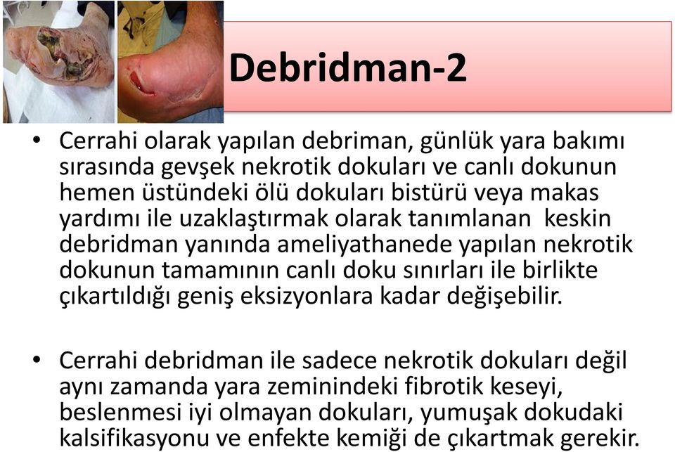 tamamının canlı doku sınırları ile birlikte çıkartıldığı geniş eksizyonlara kadar değişebilir.