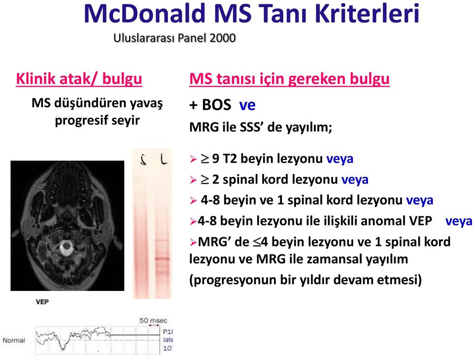 lezyonu veya 4-8 beyin ve 1 spinal kord lezyonu veya 4-8 beyin lezyonu ile ilişkili anomal VEP veya MRG