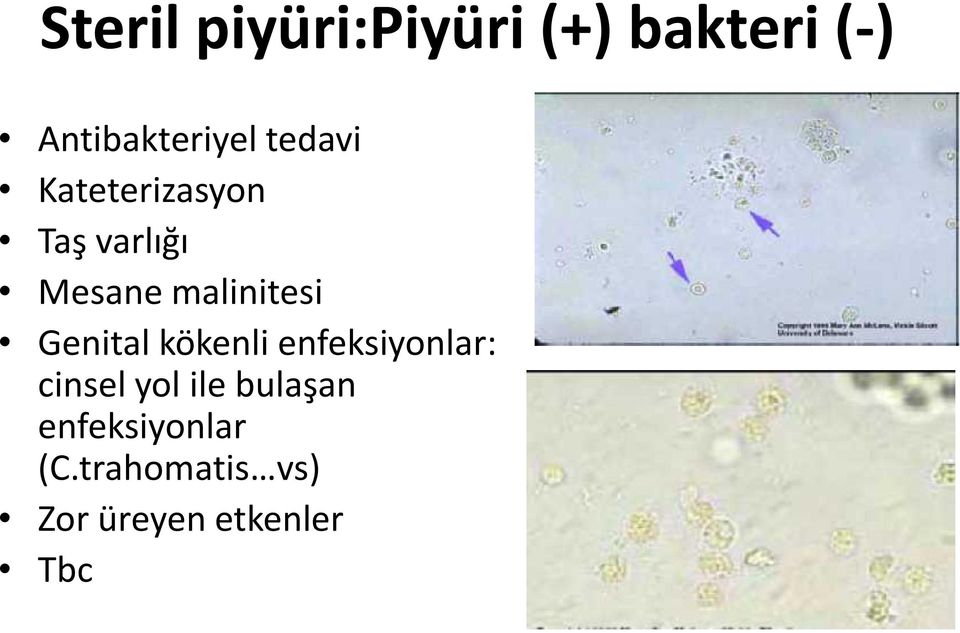 Genital kökenli enfeksiyonlar: cinsel yol ile bulaşan