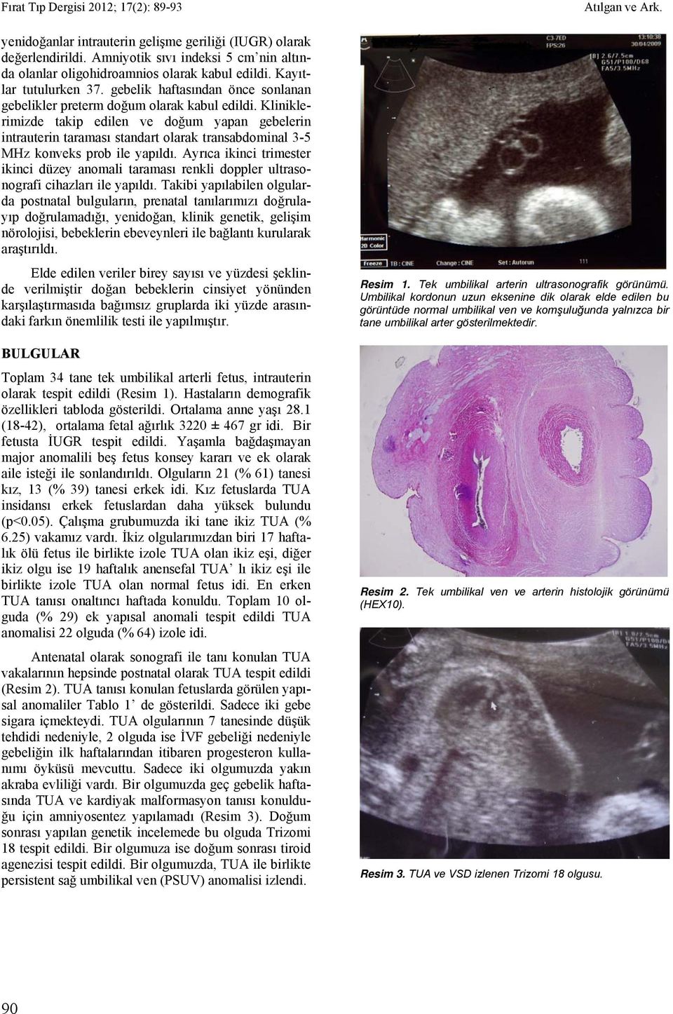 Kliniklerimizde takip edilen ve doğum yapan gebelerin intrauterin taraması standart olarak transabdominal 3-5 MHz konveks prob ile yapıldı.