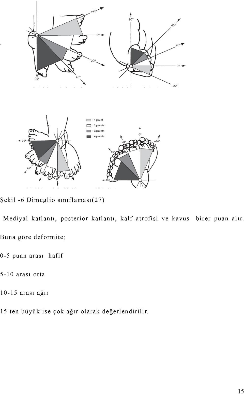 Buna göre deformite; -5 puan arası hafif 5- arası orta -5