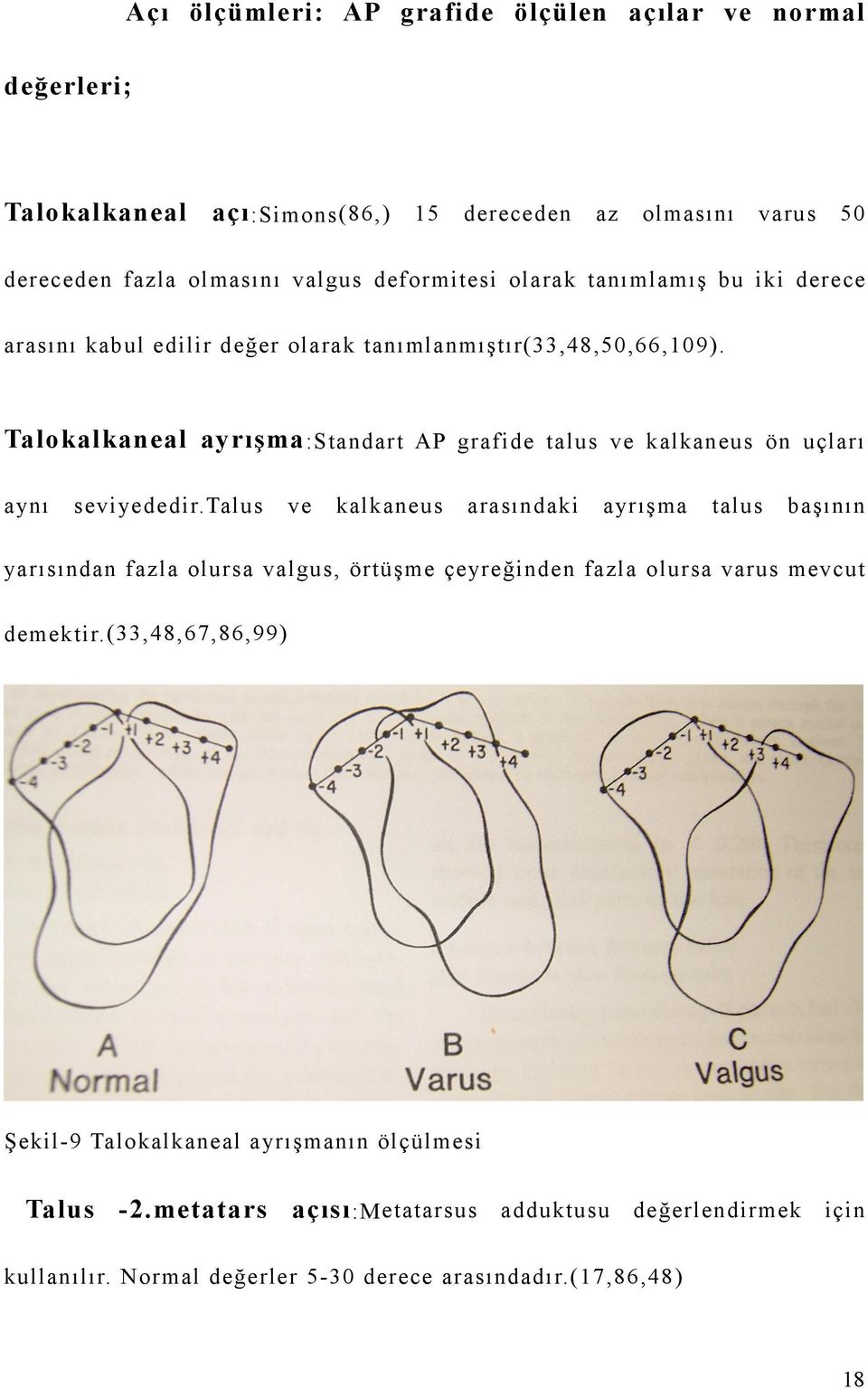 Talokalkaneal ayrışma :Standart AP grafide talus ve kalkaneus ön uçları aynı seviyededir.