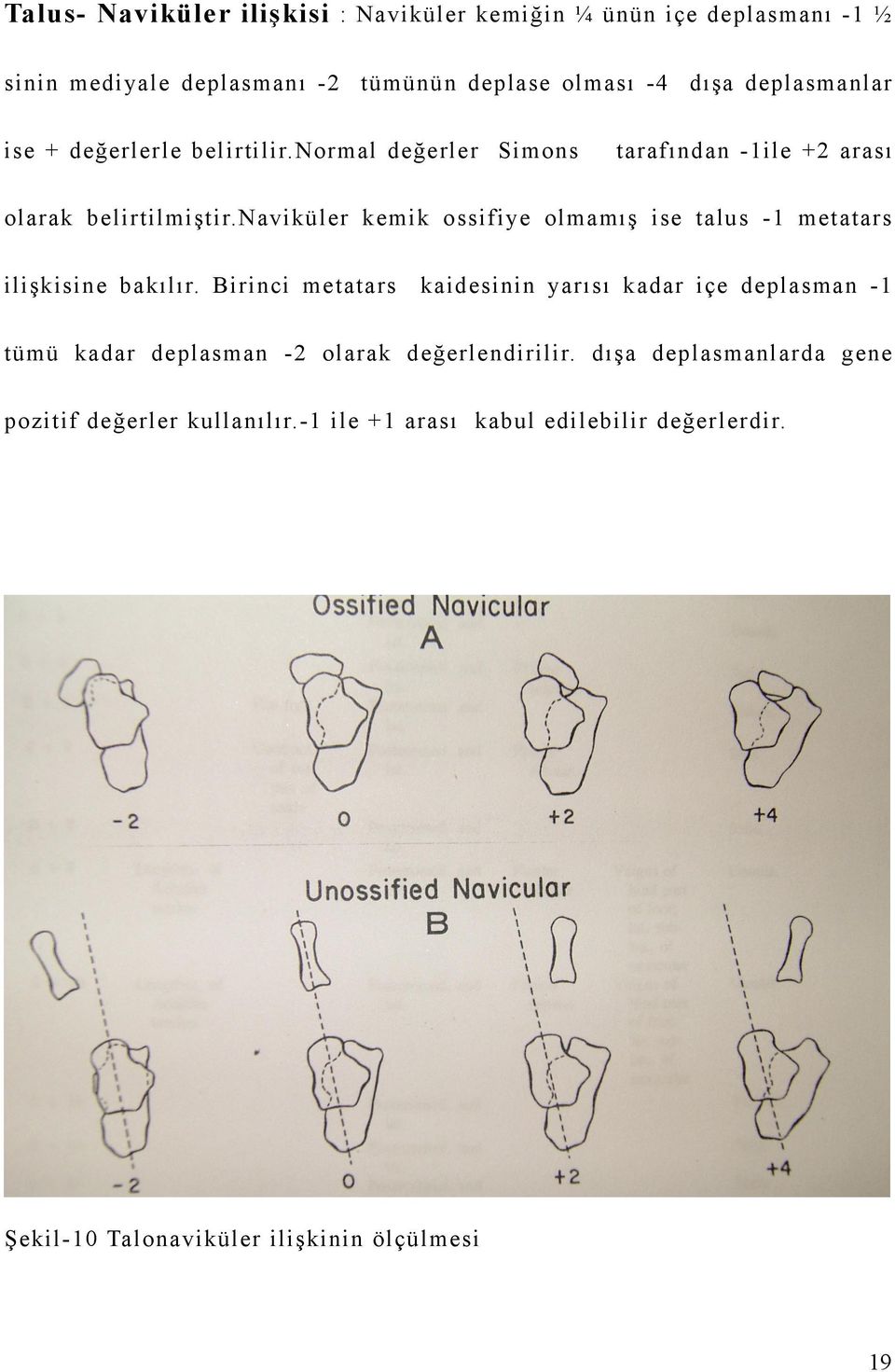 naviküler kemik ossifiye olmamış ise talus - metatars ilişkisine bakılır.