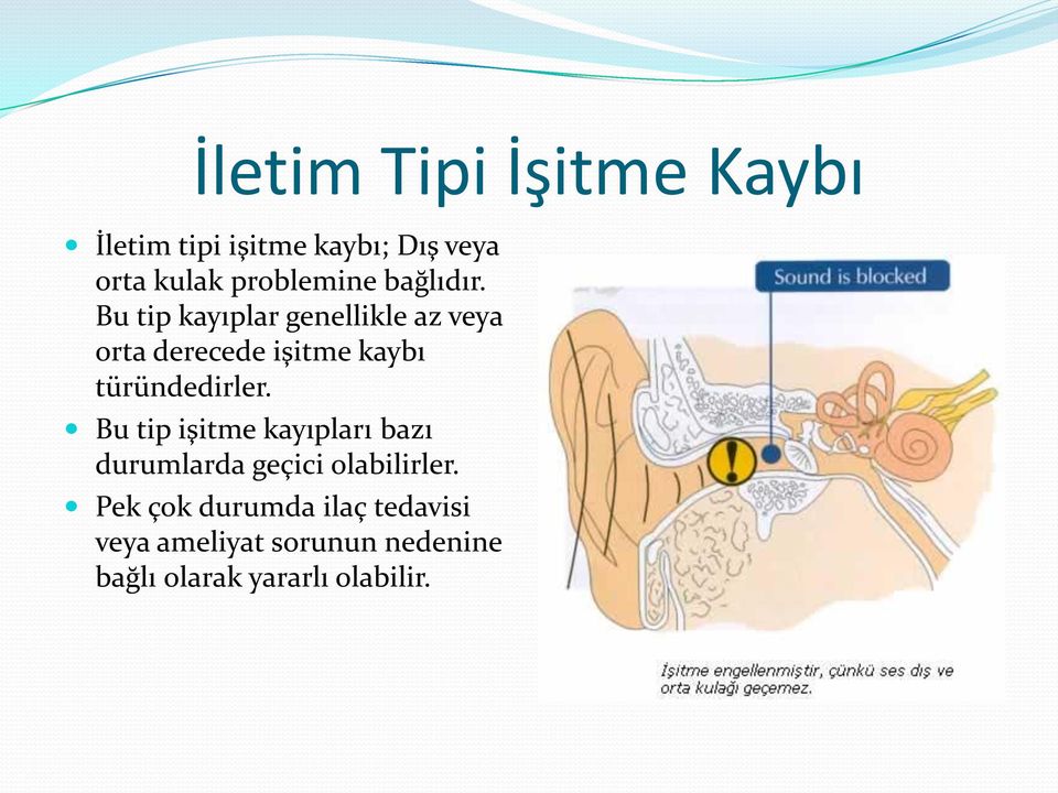 Bu tip kayıplar genellikle az veya orta derecede işitme kaybı türündedirler.