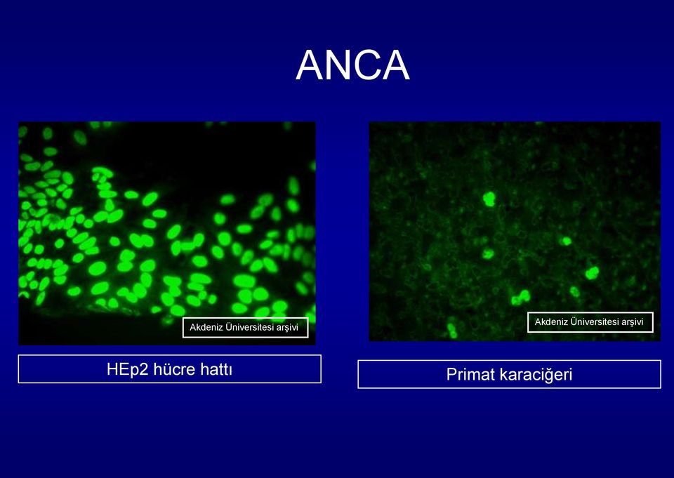 Akdeniz  HEp2 hücre