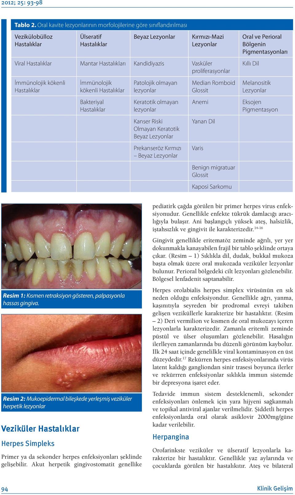 kökenli İmmünolojik kökenli Bakteriyal Patolojik olmayan lezyonlar Keratotik olmayan lezyonlar Kanser Riski Olmayan Keratotik Beyaz Lezyonlar Prekanseröz Kırmızı Beyaz Lezyonlar Median Romboid